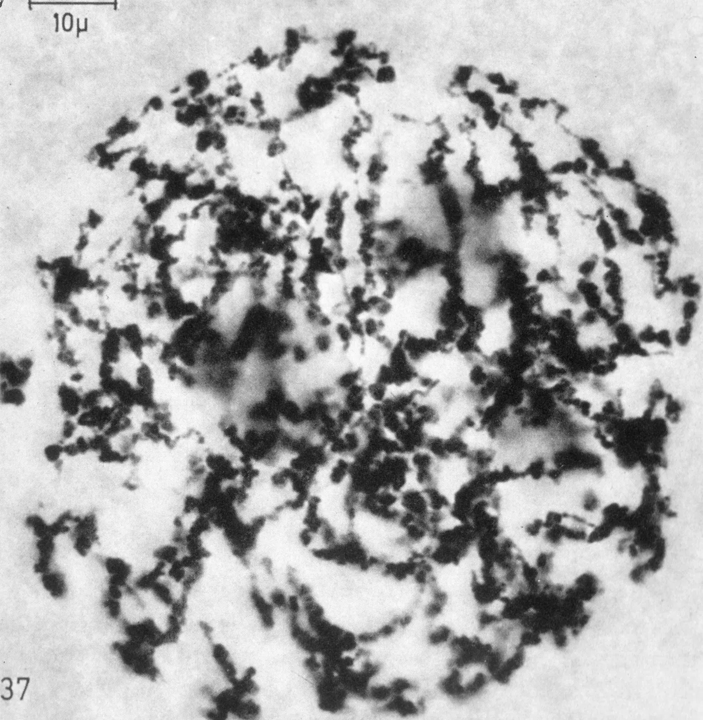 Lilium Croft mid despiralization