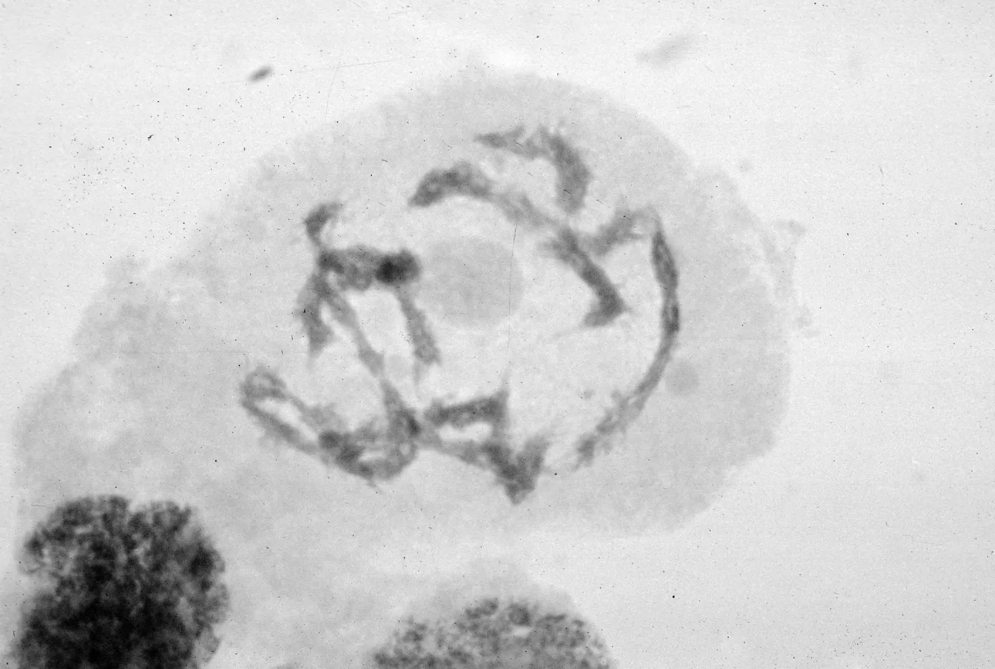 slides of meiosis in Paeonia, Paeonia californica, diakinesis, early