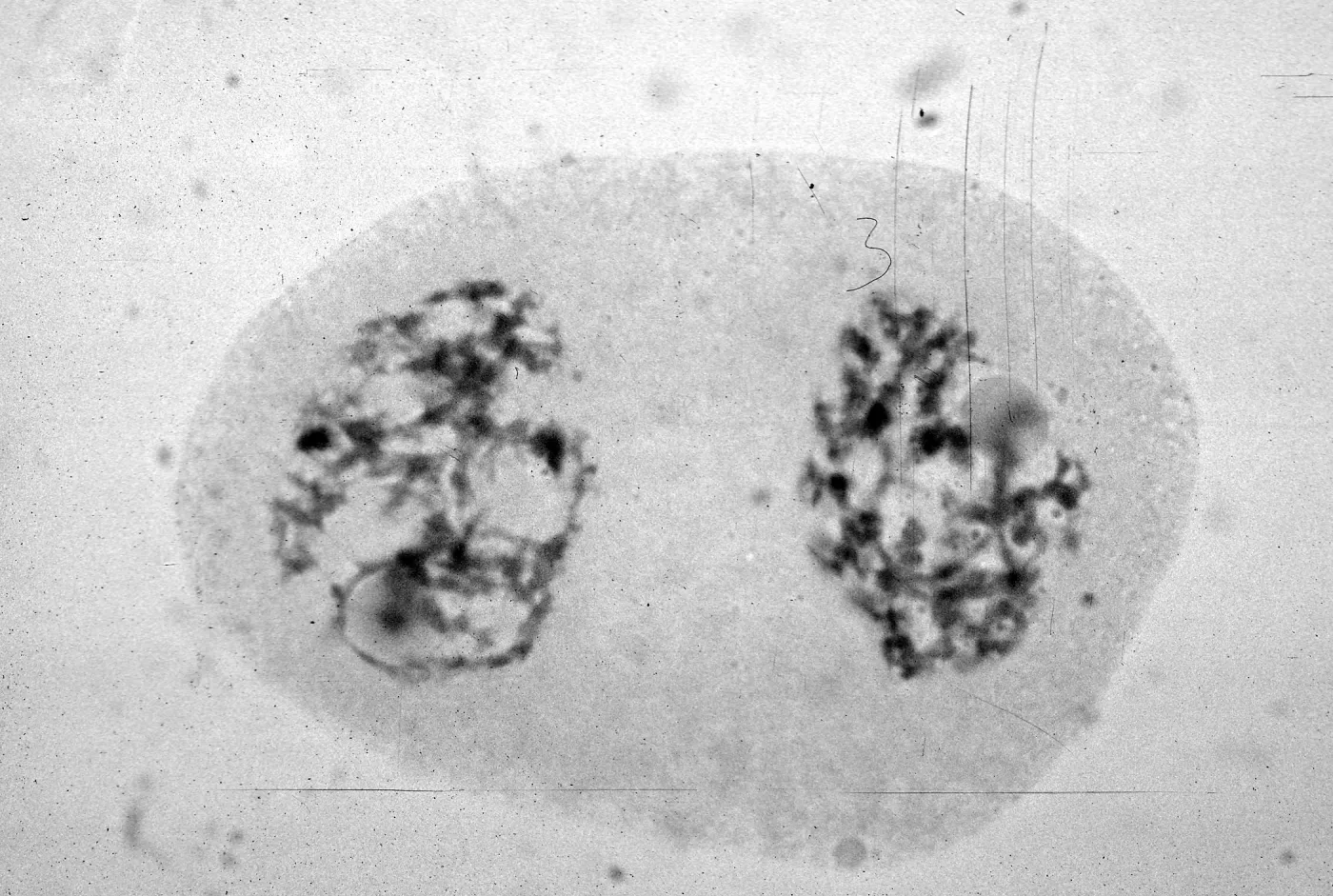 slides of meiosis in Paeonia, Paeonia californica, 11 P non-?, (6-4)
