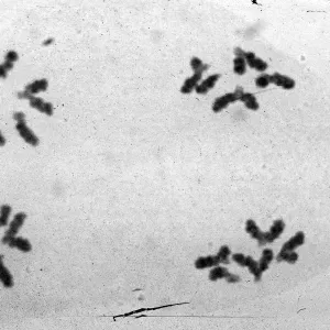 slides of meiosis in Paeonia, Paeonia californica, 11 A, double non-disjunction, D's & M's